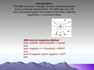 12 lead ecg | PPT