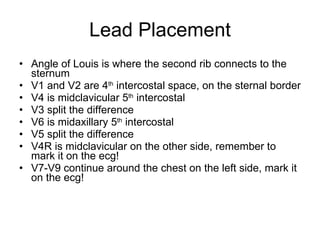 Lead Placement Angle of Louis is where the second rib connects to the sternum V1 and V2 are 4 th  intercostal space, on the sternal border V4 is midclavicular 5 th  intercostal V3 split the difference V6 is midaxillary 5 th  intercostal V5 split the difference V4R is midclavicular on the other side, remember to mark it on the ecg! V7-V9 continue around the chest on the left side, mark it on the ecg! 