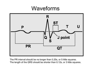 Waveforms The PR interval should be no longer than 0.20s, or 5 little squares.  The length of the QRS should be shorter than 0.12s, or 3 little squares.  
