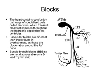 Blocks The heart contains conduction pathways of specialized cells, called fascicles, which transmit electrical impulses throughout the heart and depolarize the ventricles. Fascicular blocks are different than those found in dysrhythmias, as those are blocks at or around the AV node Bundle branch blocks (BBB’s) are not diagnoseable on a 3-lead rhythm strip 