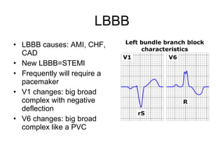 LBBB LBBB causes: AMI, CHF, CAD New LBBB=STEMI Frequently will require a pacemaker V1 changes: big broad complex with negative deflection V6 changes: big broad complex like a PVC 