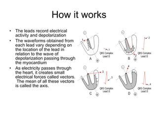 How it works The leads record electrical activity and depolarization The waveforms obtained from each lead vary depending on the location of the lead in relation to the wave of depolarization passing through the myocardium As electricity passes through the heart, it creates small electrical forces called vectors.  The mean of all these vectors is called the axis. 