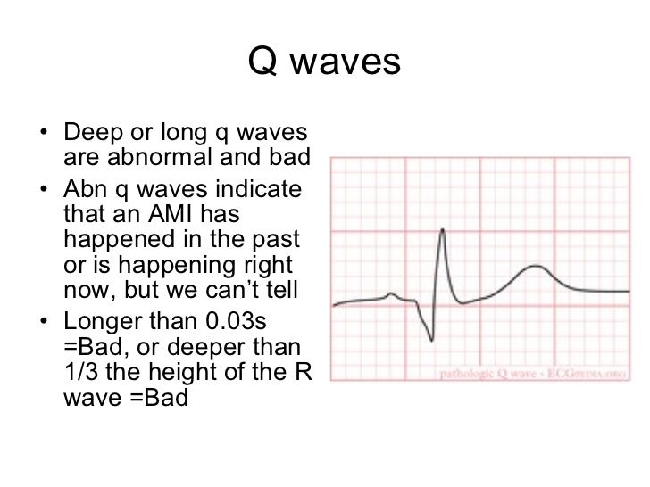 12 lead ecg