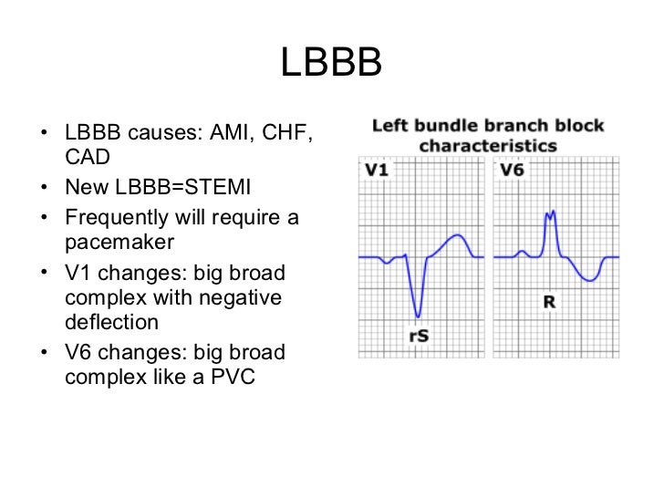 12 lead ecg