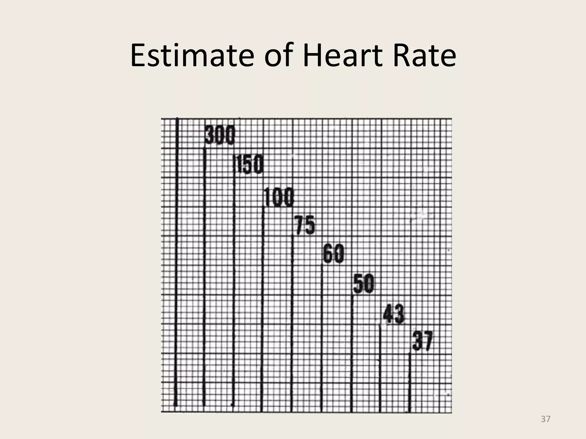 12 Lead EKG Interpretation ( PDFDrive ).pdf