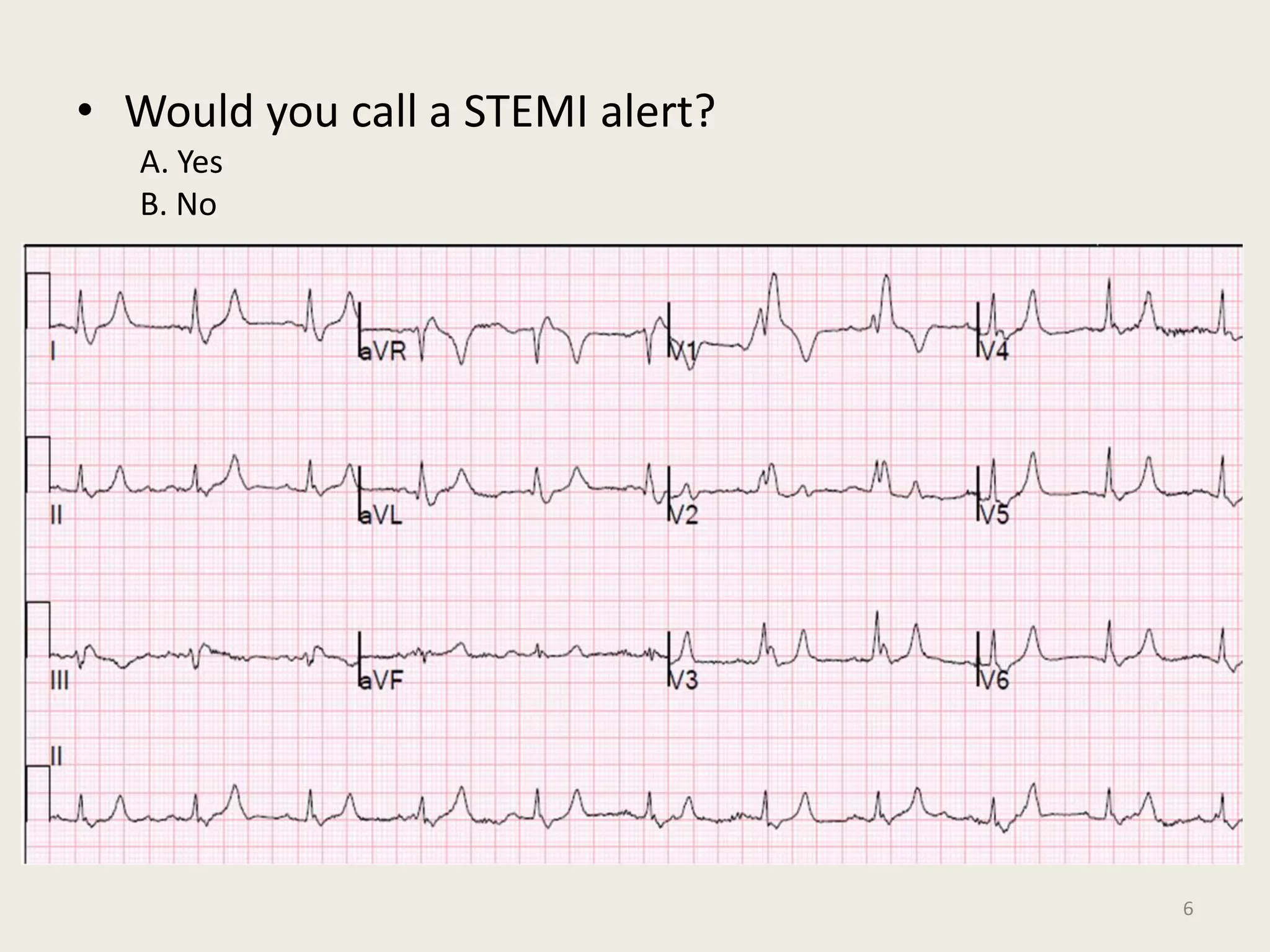 12 Lead EKG Interpretation ( PDFDrive ).pdf