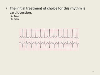 • The initial treatment of choice for this rhythm is
cardioversion.
A. True
B. False
10
 
