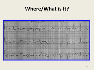 Where/What is It?
102
 