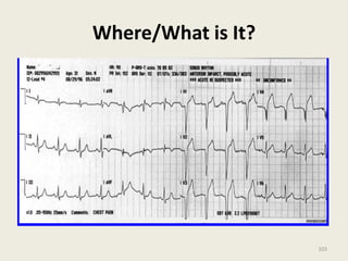 Where/What is It?
103
 