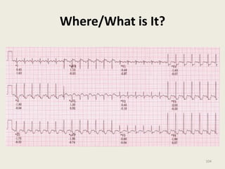 Where/What is It?
104
 