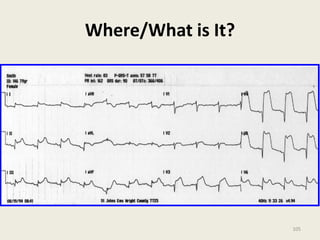 Where/What is It?
105
 