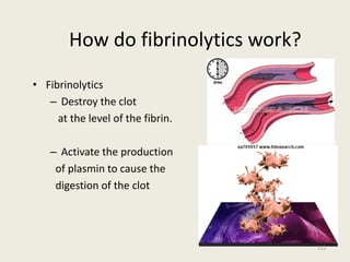 How do fibrinolytics work?
• Fibrinolytics
– Destroy the clot
at the level of the fibrin.
– Activate the production
of plasmin to cause the
digestion of the clot
112
 