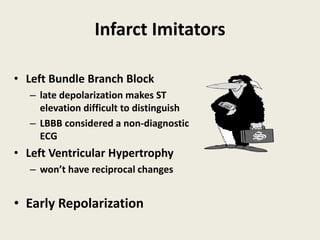 Infarct Imitators
• Left Bundle Branch Block
– late depolarization makes ST
elevation difficult to distinguish
– LBBB considered a non-diagnostic
ECG
• Left Ventricular Hypertrophy
– won’t have reciprocal changes
• Early Repolarization
 
