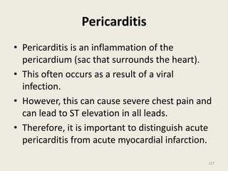 Pericarditis
• Pericarditis is an inflammation of the
pericardium (sac that surrounds the heart).
• This often occurs as a result of a viral
infection.
• However, this can cause severe chest pain and
can lead to ST elevation in all leads.
• Therefore, it is important to distinguish acute
pericarditis from acute myocardial infarction.
127
 