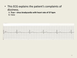 • This ECG explains the patient’s complaints of
dizziness.
A. True – sinus bradycardia with heart rate of 37 bpm
B. False
13
 