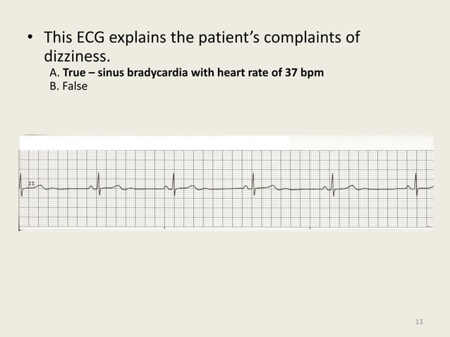 12 Lead EKG Interpretation ( PDFDrive ).pdf