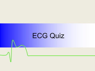 ECG Quiz
 