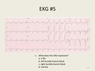 EKG #5
1. What does this EKG represent?
a. V-fib
b. left bundle branch block
c. right bundle branch block
d. normal 137
 