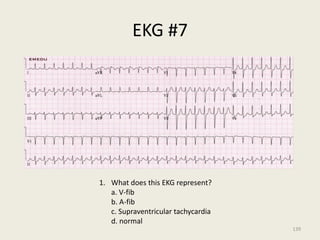 EKG #7
1. What does this EKG represent?
a. V-fib
b. A-fib
c. Supraventricular tachycardia
d. normal
139
 