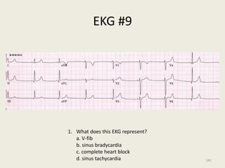 EKG #9
1. What does this EKG represent?
a. V-fib
b. sinus bradycardia
c. complete heart block
d. sinus tachycardia 141
 