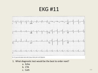 EKG #11
1. What diagnostic test would be the best to order next?
a. Echo
b. CTA
c. Cath 143
 