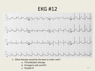 EKG #12
1. What therapy would be the best to order next?
a. Thrombolytic therapy
b. Emergent cath and PCI
c. Toradol IV 144
 