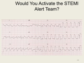 Would You Activate the STEMI
Alert Team?
146
 