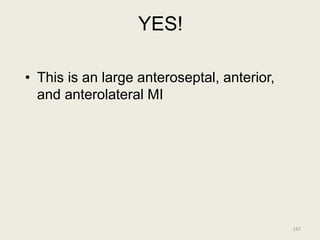 YES!
• This is an large anteroseptal, anterior,
and anterolateral MI
147
 