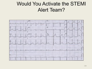 Would You Activate the STEMI
Alert Team?
148
 