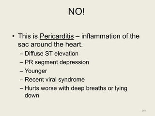 NO!
• This is Pericarditis – inflammation of the
sac around the heart.
– Diffuse ST elevation
– PR segment depression
– Younger
– Recent viral syndrome
– Hurts worse with deep breaths or lying
down
149
 