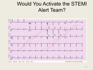 Would You Activate the STEMI
Alert Team?
157
 