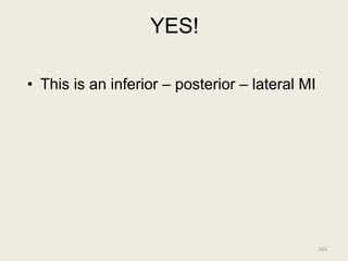 YES!
• This is an inferior – posterior – lateral MI
163
 