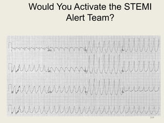 Would You Activate the STEMI
Alert Team?
164
 