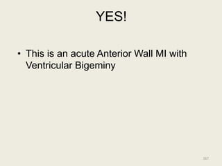 YES!
• This is an acute Anterior Wall MI with
Ventricular Bigeminy
167
 