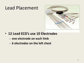 Lead Placement
• 12 Lead ECG’s use 10 Electrodes
– one electrode on each limb
– 6 electrodes on the left chest
20
 