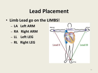 Lead Placement
• Limb Lead go on the LIMBS!
– LA Left ARM
– RA Right ARM
– LL Left LEG
– RL Right LEG
21
 