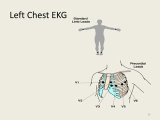 Left Chest EKG
23
 