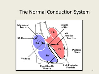 The Normal Conduction System
24
 