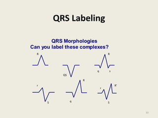 QRS Labeling
QRS Morphologies
Can you label these complexes?
R
QS
q
R
s
r
S q
R
r
S
R’
33
 