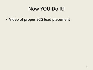 Now YOU Do It!
• Video of proper ECG lead placement
34
 