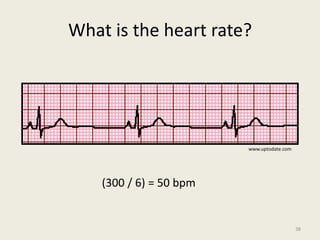 What is the heart rate?
(300 / 6) = 50 bpm
www.uptodate.com
38
 