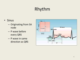 Rhythm
• Sinus
– Originating from SA
node
– P wave before
every QRS
– P wave in same
direction as QRS
41
 
