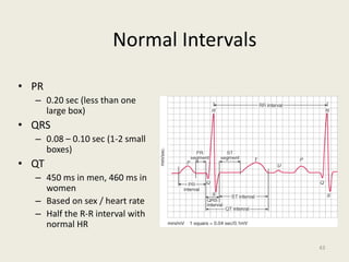 Normal Intervals
• PR
– 0.20 sec (less than one
large box)
• QRS
– 0.08 – 0.10 sec (1-2 small
boxes)
• QT
– 450 ms in men, 460 ms in
women
– Based on sex / heart rate
– Half the R-R interval with
normal HR
43
 