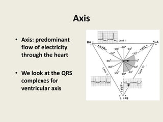 Axis
• Axis: predominant
flow of electricity
through the heart
• We look at the QRS
complexes for
ventricular axis
 