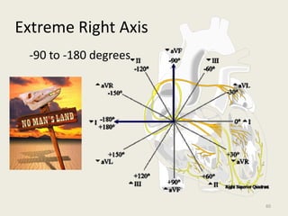 Extreme Right Axis
-90 to -180 degrees
60
 