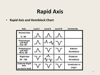 Rapid Axis
• Rapid Axis and Hemiblock Chart
Lead I Lead II Lead III
Axis
Normal Axis
0 - 90
Physiologic
Left Axis
0 to -40
Pathological
Left Axis
-40 to -90
Right Axis
90 - 180
Extreme Right
Axis
Anterior
Hemiblock
Hemiblock
Posterior
no man's land
Ventricular in
origin
Comments
70
 