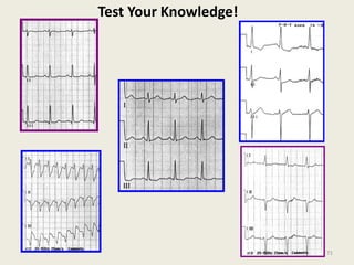 Test Your Knowledge!
71
 