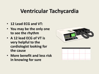 Ventricular Tachycardia
• 12 Lead ECG and VT:
• You may be the only one
to see the rhythm
• A 12 lead ECG of VT is
very helpful to the
cardiologist looking for
the cause
• More benefit and less risk
in knowing for sure
 