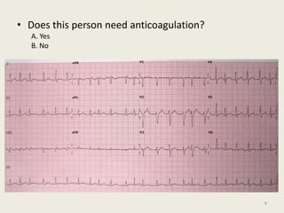 • Does this person need anticoagulation?
A. Yes
B. No
8
 