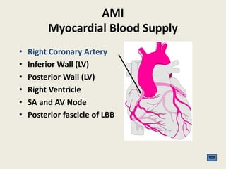 AMI
Myocardial Blood Supply
• Right Coronary Artery
• Inferior Wall (LV)
• Posterior Wall (LV)
• Right Ventricle
• SA and AV Node
• Posterior fascicle of LBB
 